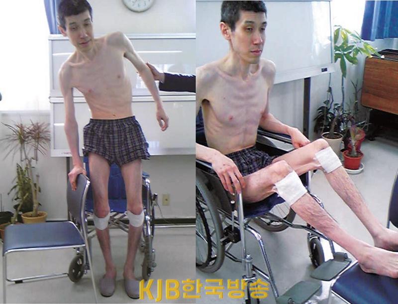 12년 5개월 동안 납치감금 된 직후의 고토 토오루 대표 (2008년 당시, 182cm, 약 50kg).jpg